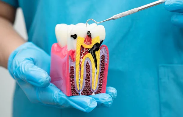 Root Canal Treatment