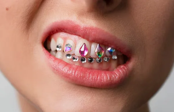 Tooth Crystal