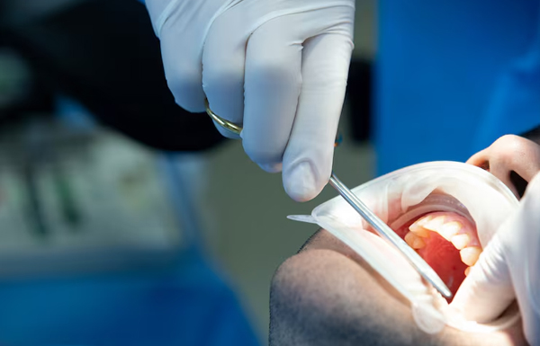 Gum Surgery