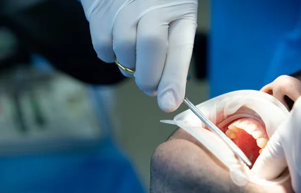 Gum Surgery