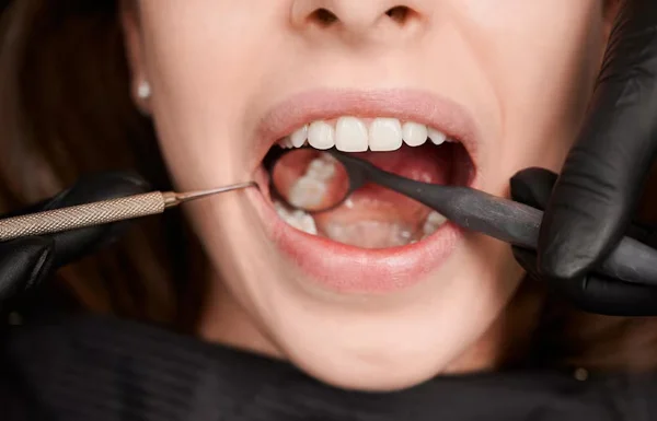 Socket Preservation Therapy