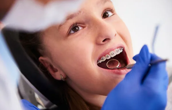 Braces