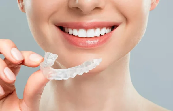 Clear Aligners